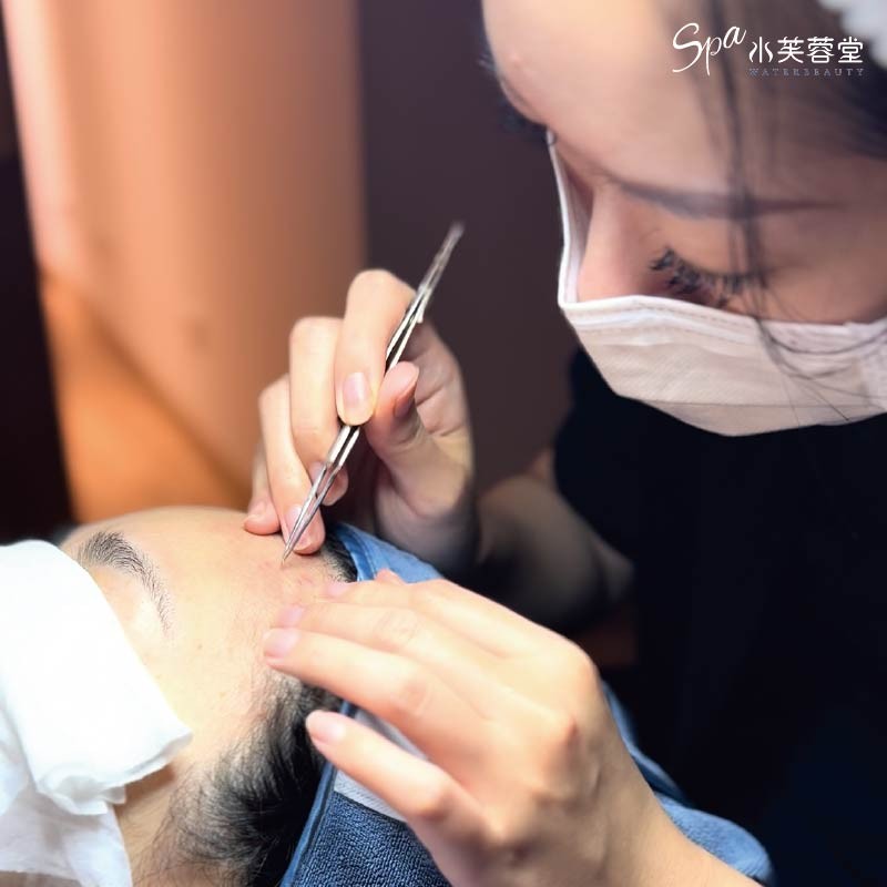 粉刺淨化舒芙蓉