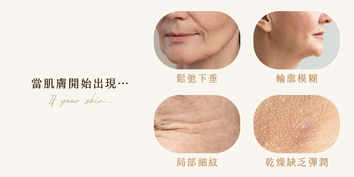 3V逆齡膠原蛋白線雕