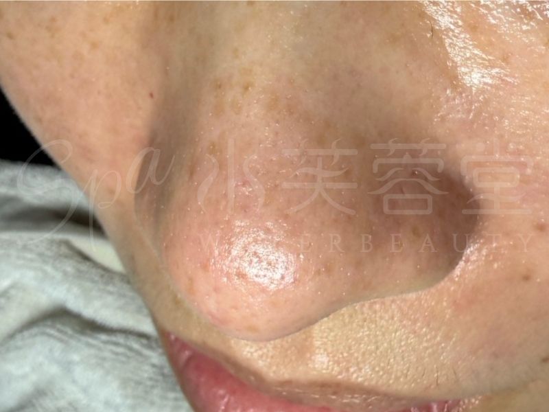酵素美人肌煥亮潔膚課程 酵素美人肌煥亮潔膚課程