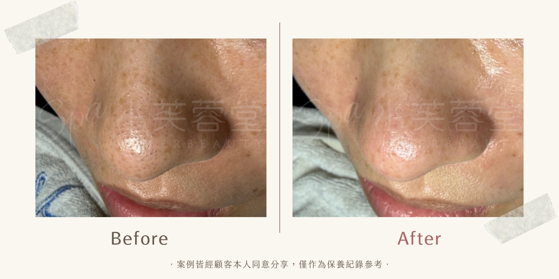 酵素美人肌煥亮潔膚