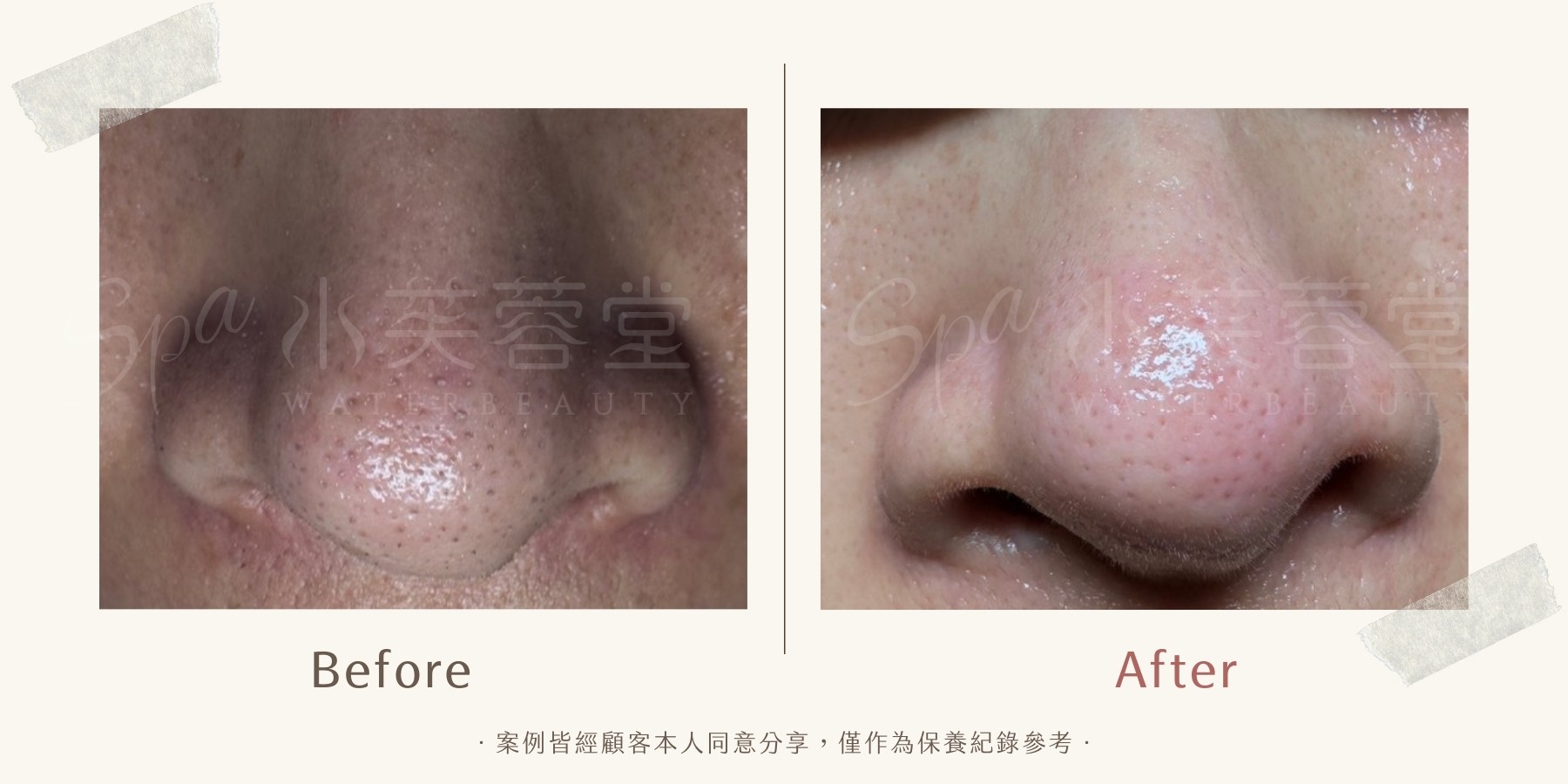 酵素美人肌煥亮潔膚