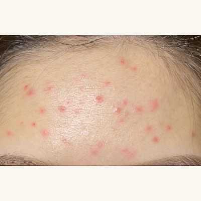 酵素美人肌煥亮潔膚