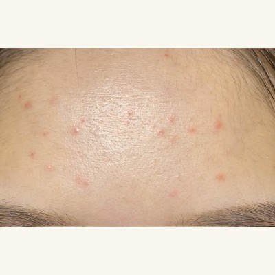 酵素美人肌煥亮潔膚