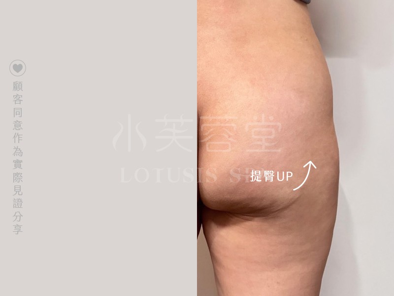 馬蹄纖體SPA