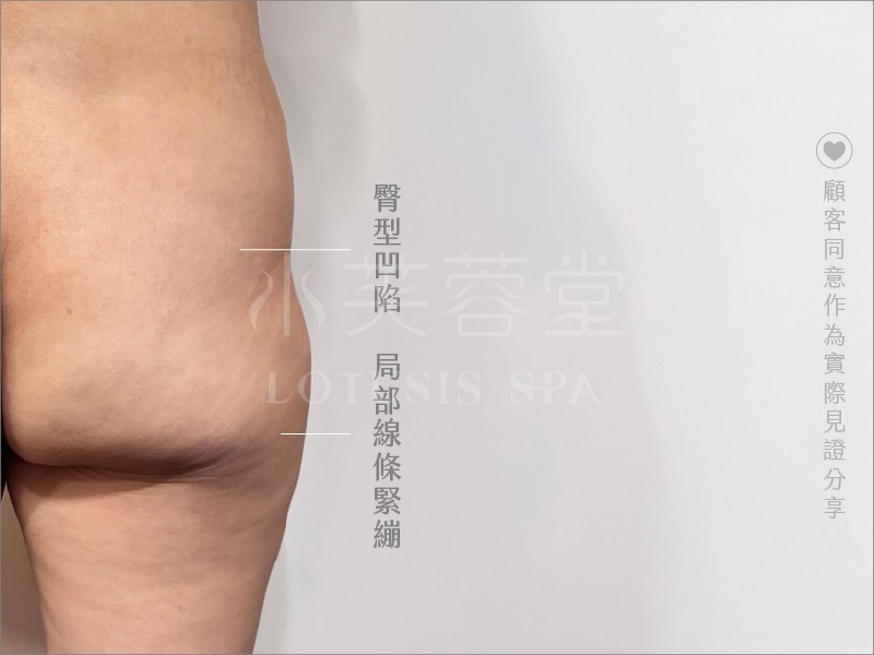 馬蹄纖體SPA