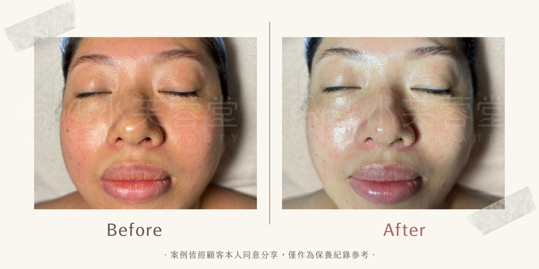 面若桃花淨化撥筋