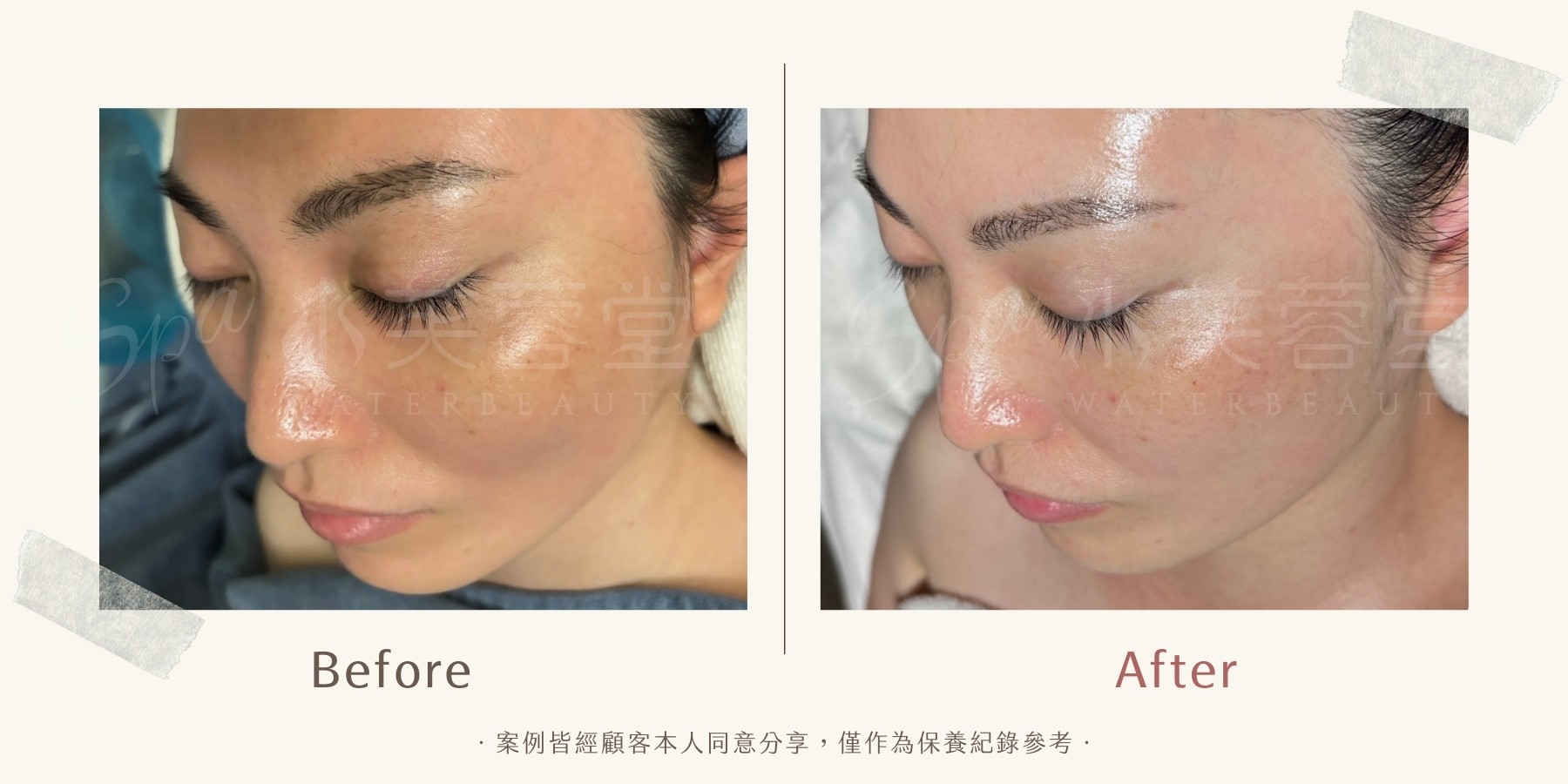 面若桃花淨化撥筋