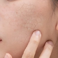 液態皮秒天使肌光感課程 液態皮秒天使肌光感課程