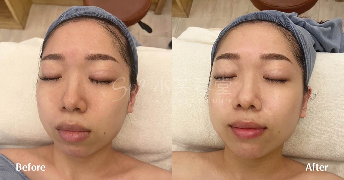 煥顏玫瑰賦活SPA