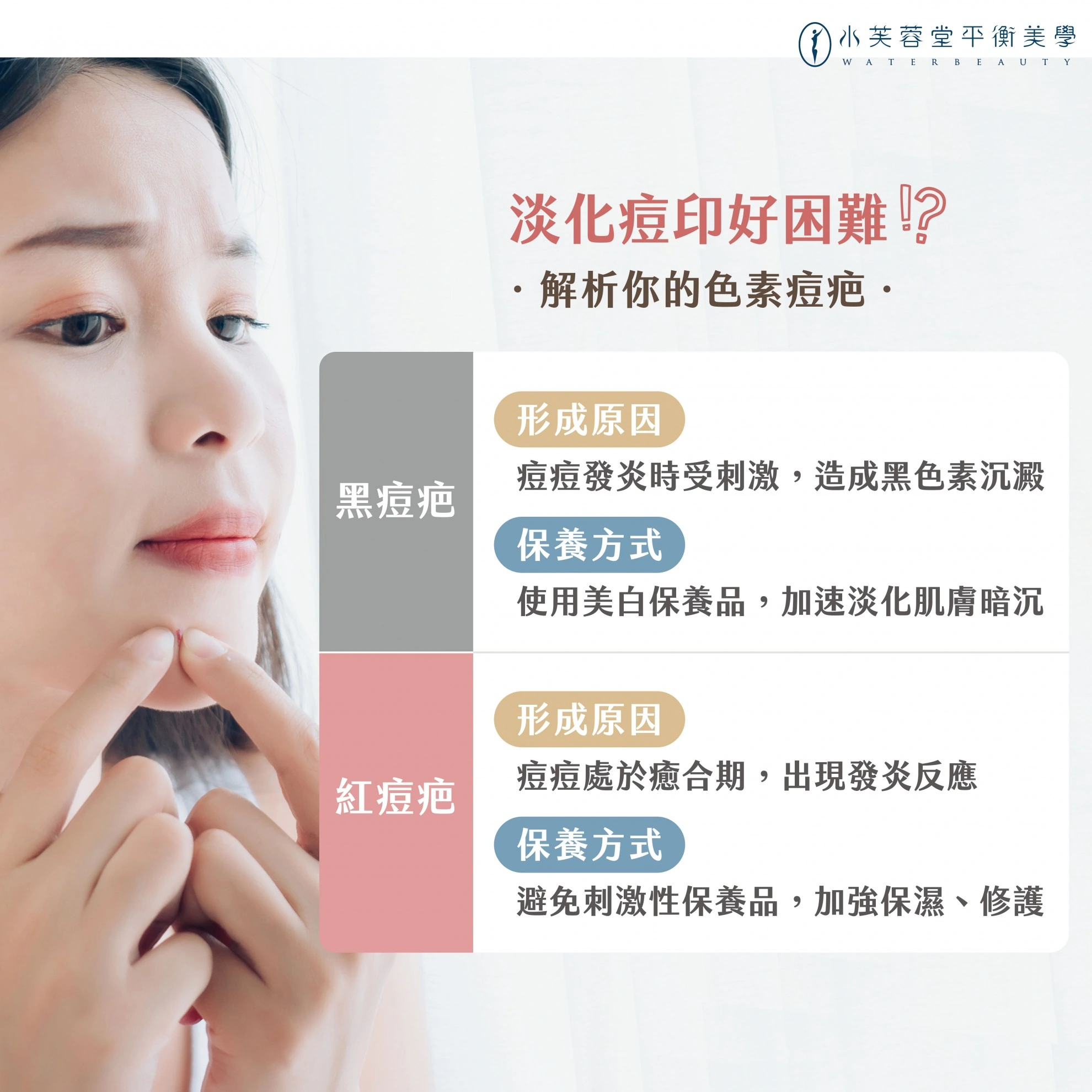 淡化痘疤痘印有方法 淡化痘疤痘印有方法