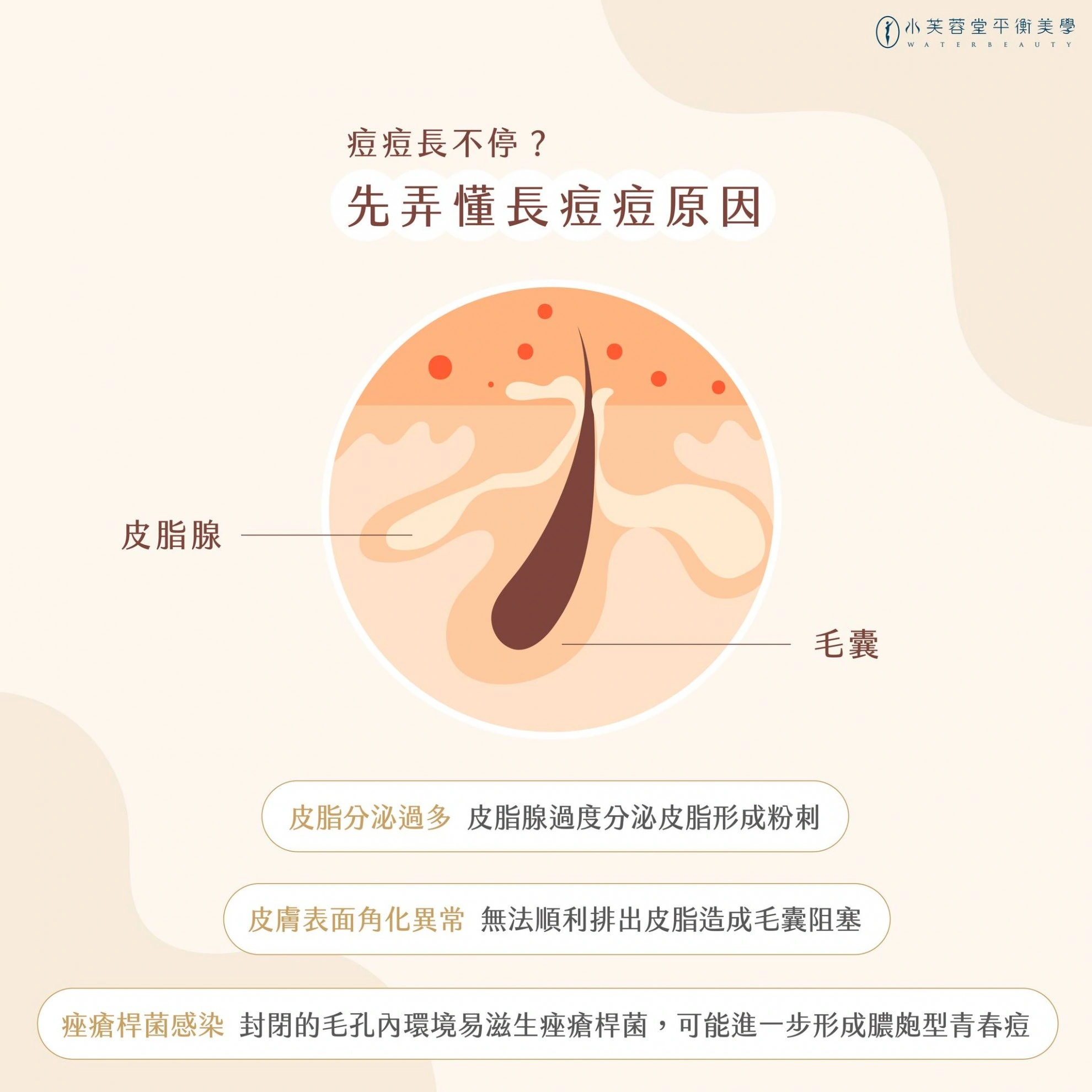 痘痘長不停,到底是什麼原因 痘痘長不停,到底是什麼原因