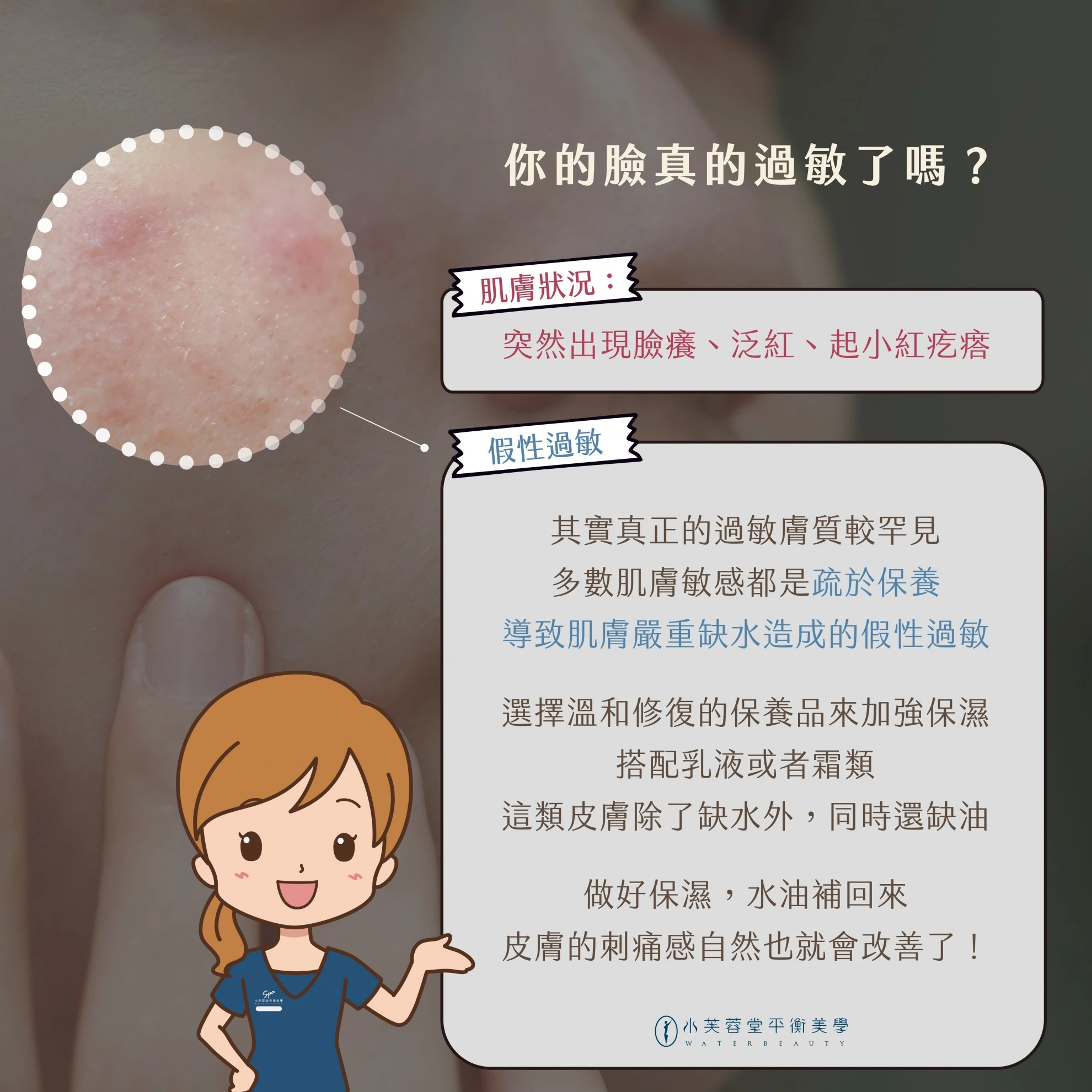 臉又過敏了?不,這是肌膚缺水警報! 臉又過敏了?不,這是肌膚缺水警報!