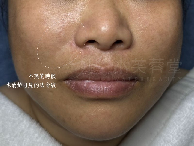 水芙蓉堂臉部保養經典課程,四大攻略+進階保養,完整守護妳的無暇美肌 水芙蓉堂臉部保養經典課程,四大攻略+進階保養,完整守護妳的無暇美肌