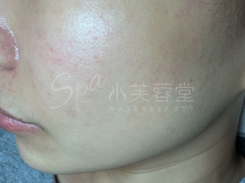 水芙蓉堂臉部保養經典課程,四大攻略+進階保養,完整守護妳的無暇美肌 水芙蓉堂臉部保養經典課程,四大攻略+進階保養,完整守護妳的無暇美肌